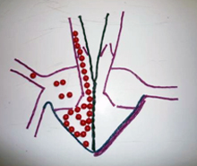 Tactile illustration of blood flow