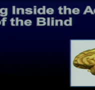 Slide of adaptive brain